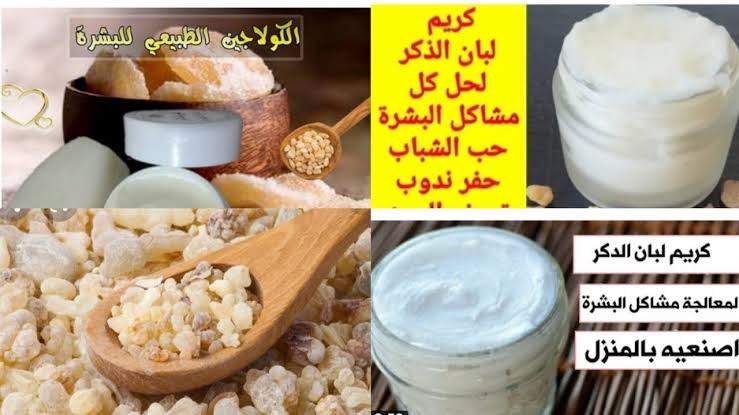 «حتى لو عمرك عدى ال70».. إليك طريقة تحضير كريم لبان الذكر لإزالة التجاعيد ويؤخر من ظهور علامات التقدم في العمر 5 «حتى لو عمرك عدى ال70».. إليك طريقة تحضير كريم لبان الذكر لإزالة التجاعيد ويؤخر من ظهور علامات التقدم في العمر