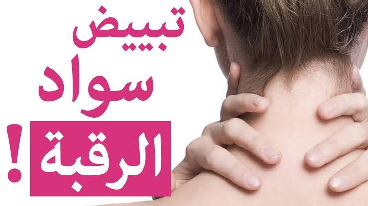 المفعول السحري.. وصفات طبيعية لتفتيح الأماكن الداكنة والرقبة والقضاء على سواد السنين في وقت قياسي 5 المفعول السحري.. وصفات طبيعية لتفتيح الأماكن الداكنة والرقبة والقضاء على سواد السنين في وقت قياسي