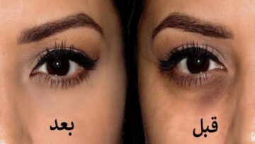 ندمت اني مش معرفهاش.. بكيس خميرة صغير هتتخلصي من الهالات السوداء نهائيا في 5 دقائق