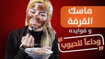 وداعاً لحبوب الشباب.. سحر القرفة والعسل هينضف بشرتك ويخليها اجمل من القمر