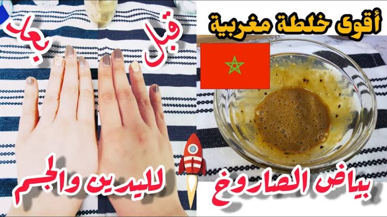 صاحبتي قالتلي عليها.. اقوى وصفة مغربية لتفتيح وتبييض الجسم خلال 3 أيام 5 صاحبتي قالتلي عليها.. اقوى وصفة مغربية لتفتيح وتبييض الجسم خلال 3 أيام