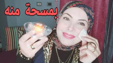 نتيجة خيالية.. بمكونات طبيعية هتتخلصي من الكلف خلال 10 ايام