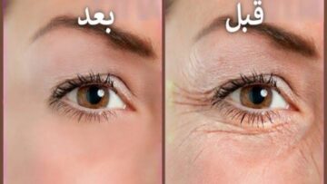 وداعاً للشيخوخة.. معجزة جل الصبار هتخليكي شكلك شباب من تاني بطريقة مذهلة