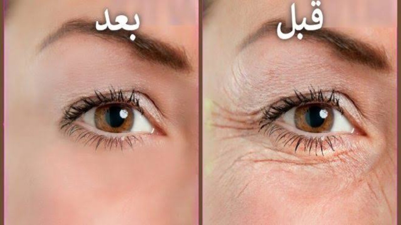 وداعاً للشيخوخة.. معجزة جل الصبار هتخليكي شكلك شباب من تاني بطريقة مذهلة