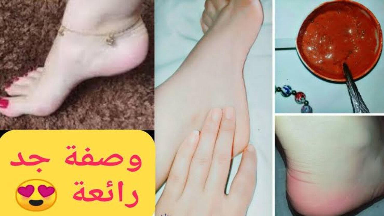 جمالك هيكمل بكعب منور.. مقشر خل التفاح للقدمين هيشيل التشققات في 15 دقيقة فقط 5 جمالك هيكمل بكعب منور.. مقشر خل التفاح للقدمين هيشيل التشققات في 15 دقيقة فقط