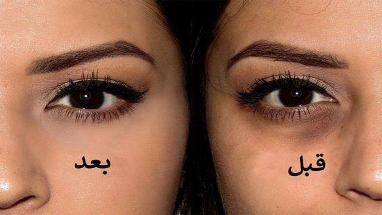 وصفة سحرية للتخلص من التجاعيد والهالات السوداء بسرعة البرق