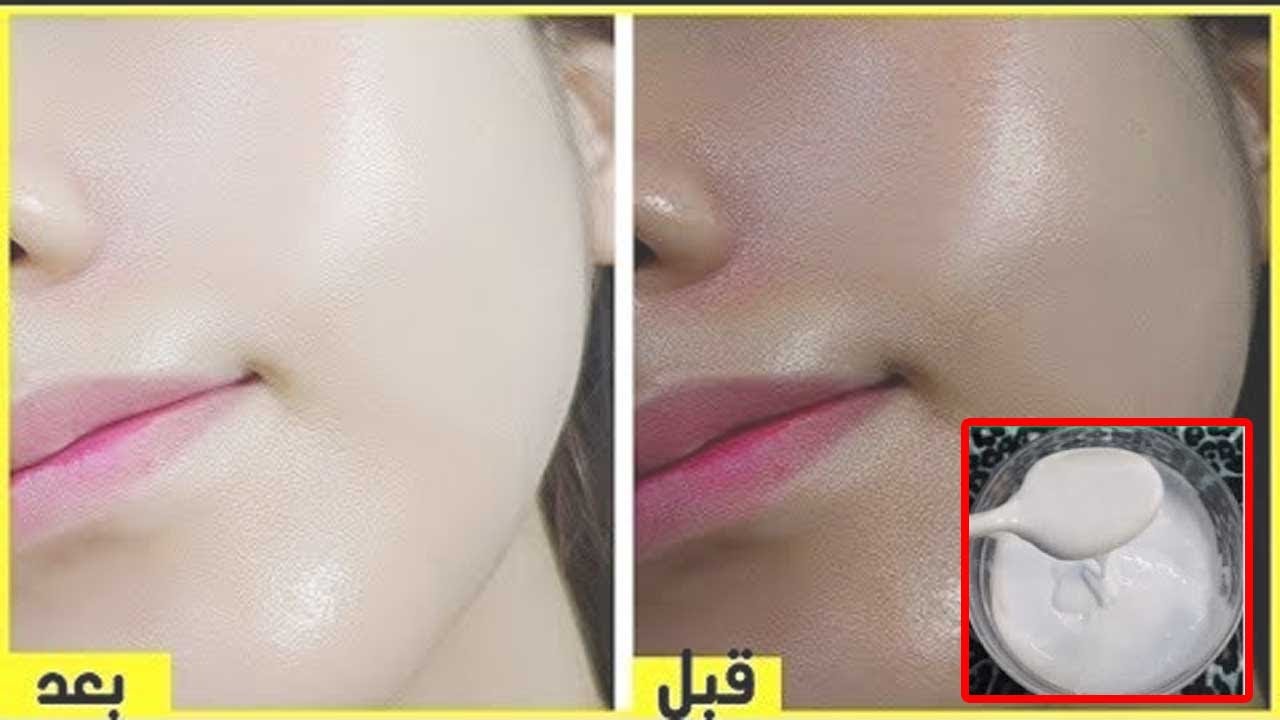بياض ملفت  بالنشا والزبادي تبييض وتفتيح للبشرة وإزالة سواد السنين