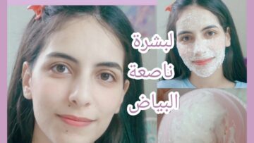 طريقة عمل اقوى خلطة لتبيض الوجه والجسم كله وإزالة البقع والتصبغات نهائيا من اول استعمال 