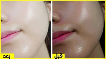 ” من حلاوتك هتخليهم يحسدوكي” .. حطي الوصفة السحرية على بشرتك قبل الخروج هتبقي زي أميرة الثلج