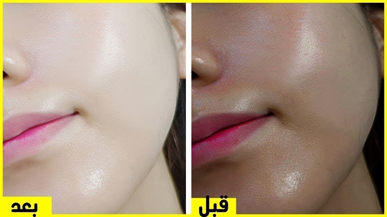 ” من حلاوتك هتخليهم يحسدوكي” .. حطي الوصفة السحرية على بشرتك قبل الخروج هتبقي زي أميرة الثلج