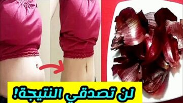 بدون رجيم هتخسي.. ” نسف دهون الكرش والبطن بقشور البصل هتشوفي وزنك بعد أسبوع