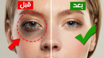 لجمال عيونك.. ” ماسك الشاي الاخضر وصفة اقتصادية هتخلصك من الهالات السوداء عند استعماله هتلاحظي الفرق