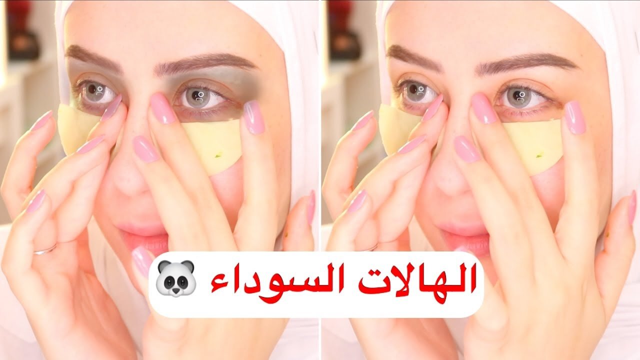 هيخلي وشك ينور.. سيروم طبيعي مفعوله جبار هيخلي بشرتك نضيفة وجميلة 5 هيخلي وشك ينور.. سيروم طبيعي مفعوله جبار هيخلي بشرتك نضيفة وجميلة