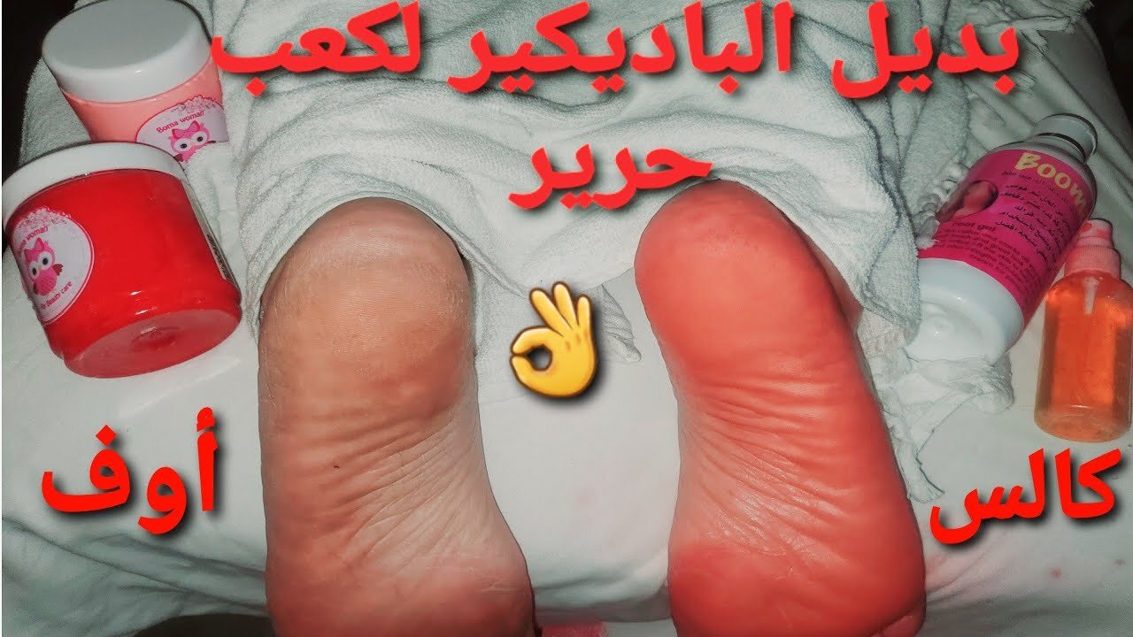 كعوبك مراية جمالك.. مكون خارق لإزالة التشققات من القدمين بدون باديكير وفي 15 دقيقة 5 كعوبك مراية جمالك.. مكون خارق لإزالة التشققات من القدمين بدون باديكير وفي 15 دقيقة