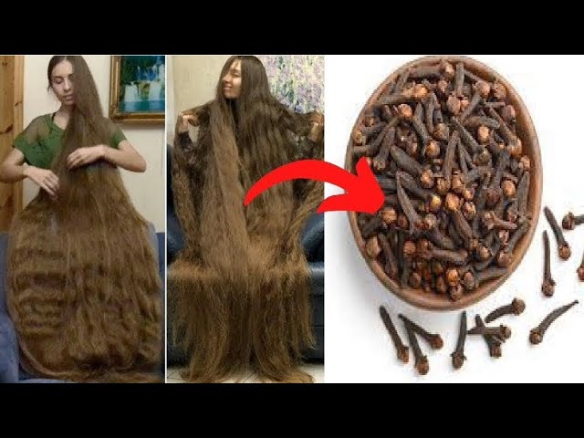 الشعر يطول بسرعة مجنونة القرنفل رشة واحدة علي الفراغات والصلع لن تصدقي طول وكثافة شعرك