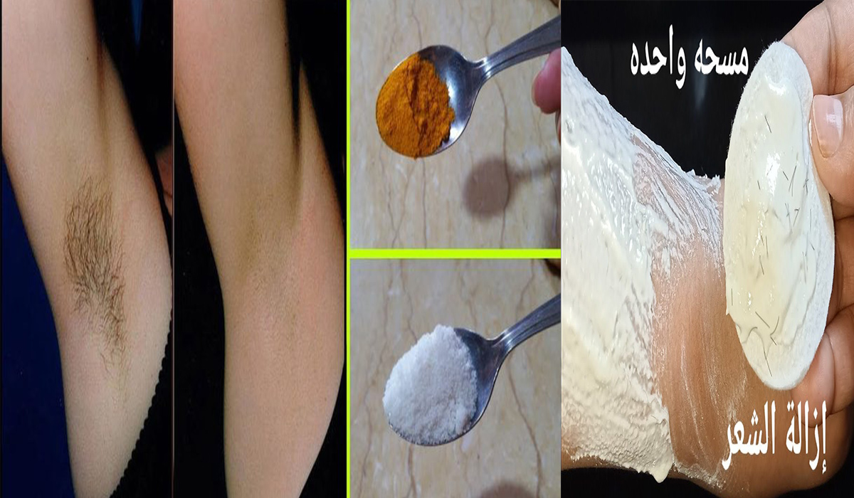 بالحمص قومي بإزالة الشعر بدون ألم من الجسم والوجه بوصفة مجربة وغير مكلفة