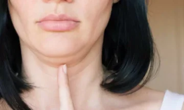 وداعًا للترهلات أسفل منطقة الذقن والرقبة..إليك أفضل الخلطات الطبيعية للتخلص منها بطريقة آمنة