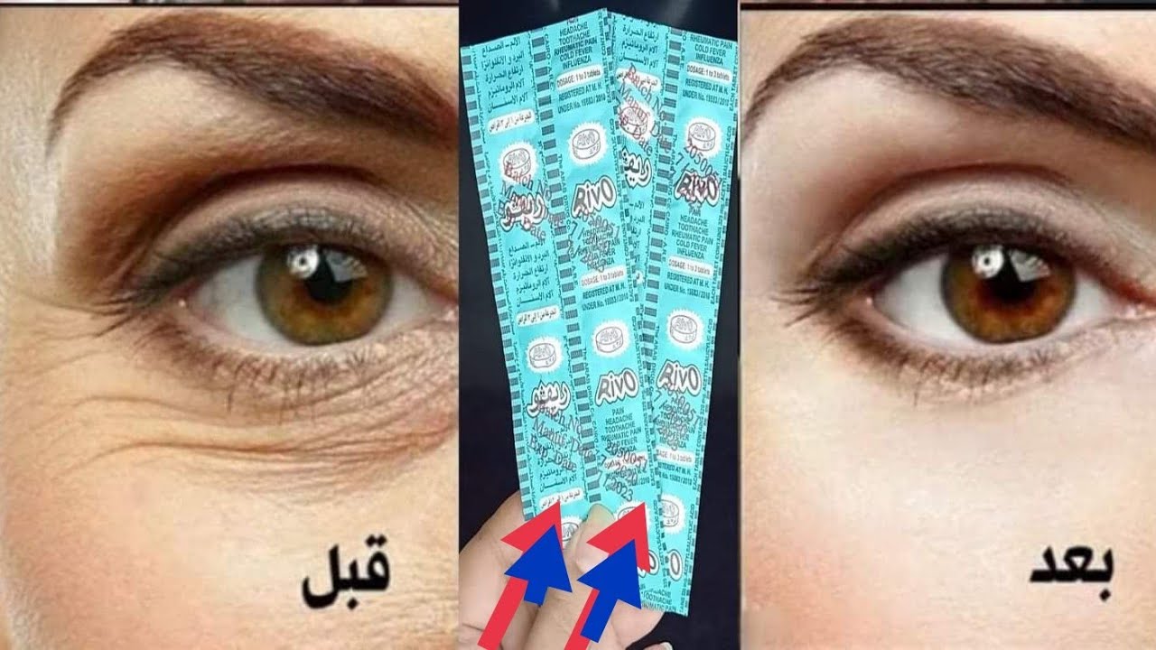 لن تحتاجي للبوتكس أو الفيلر بقرص أسبرين واحد تخلصي من التجاعيد واحصلي على بشرة مثالية 5 لن تحتاجي للبوتكس أو الفيلر بقرص أسبرين واحد تخلصي من التجاعيد واحصلي على بشرة مثالية