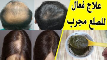 طوليه لحد الأرض.. ” وصفة فريدة سيف النصر مجربة لانبات فراغات شعرك وتطويله 10 سم بسرعة.. جربيها وهتدعيلي