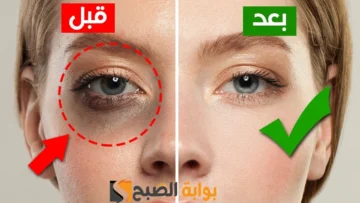 عيونك هتنور من تاني .. أفضل الوصفات الفعالة والمعالجة لإزالة الهالات السوداء حول العين “هتوفر لك فلوس الكونسيلر”