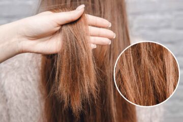 وصفة طبيعية للتخلص من مشكلة تساقط الشعر بعلاج طبيعي