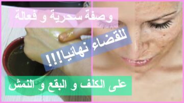 “هتلمعي زي النجوم” خلطة سحرية وفعالة للقضاء علي الكلف والنمش بطريقة طبيعية لبشرة نقية