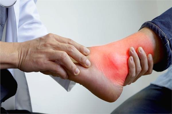 أفضل علاج نهائي للنقرس بطريقة طبيعية تخلص من الألم في أيام فقط