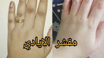 تقشير اليدين بـ 4 وصفات طبيعية بدون كريمات أو أحماض مضرة على بشرتك