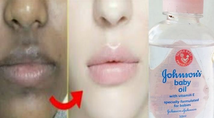هدية للعرايس.. كريم زيت جونسون والنشا لتبييض الجسم الأسمر كله من البقع يزيل سواد 10سنين في ربع ساعة هتبقي بيضاء زي القشطة 5 هدية للعرايس.. كريم زيت جونسون والنشا لتبييض الجسم الأسمر كله من البقع يزيل سواد 10سنين في ربع ساعة هتبقي بيضاء زي القشطة