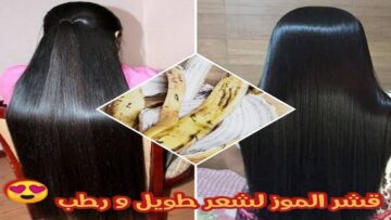 وفري فلوس الكوافير.. قشور الموز كنز ثمين يساعد في التخلص من مشاكل الشعر مش هترميه تاني