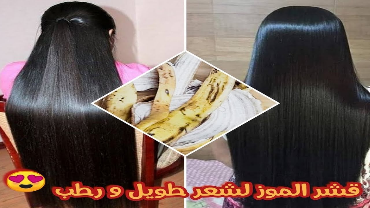 وفري فلوس الكوافير.. قشور الموز كنز ثمين يساعد في التخلص من مشاكل الشعر مش هترميه تاني