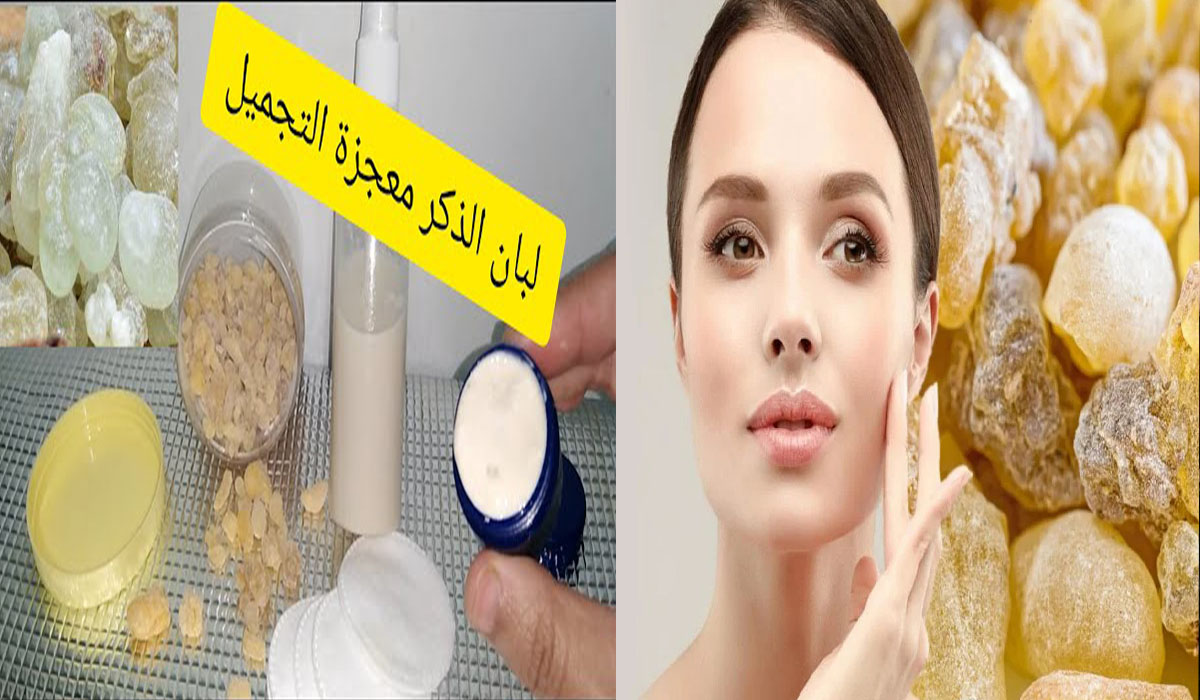 أعملي كريم لبان الذكر لتبييض المناطق الداكنة وإزالة حب الشباب بأقل تكلفة 6 أعملي كريم لبان الذكر لتبييض المناطق الداكنة وإزالة حب الشباب بأقل تكلفة
