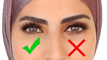 أسرع طريقة للتخلص من التجاعيد تحت العين وتراهل الجفن والانتفاخ