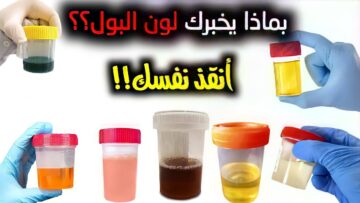 لون البول قد يشير أنك تعانى من مرض خطير تعرف عليه قبل فوات الأوان