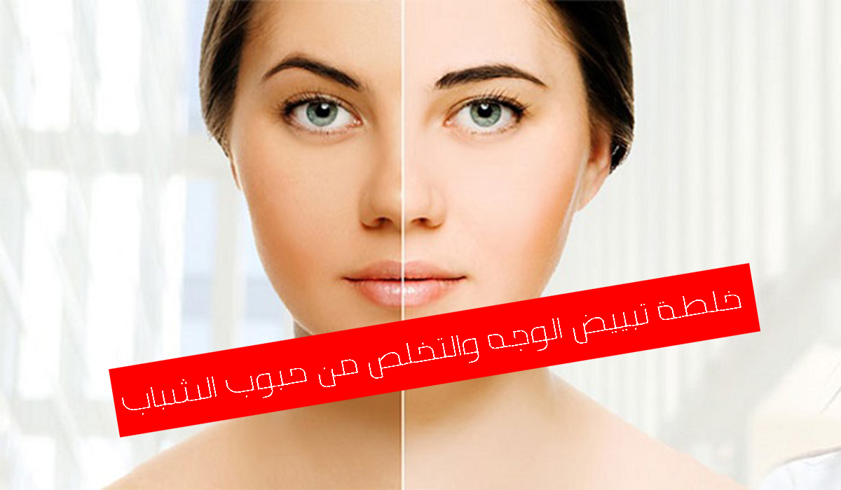تعالي أقولك على وصفات تبييض وعلاج حب الشباب بالزبادي 5 تعالي أقولك على وصفات تبييض وعلاج حب الشباب بالزبادي