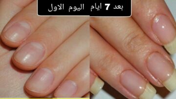 إليك أهم 3 وصفات طبيعية لأظافر أكثر طولًا وقوة في أسبوع واحد بس