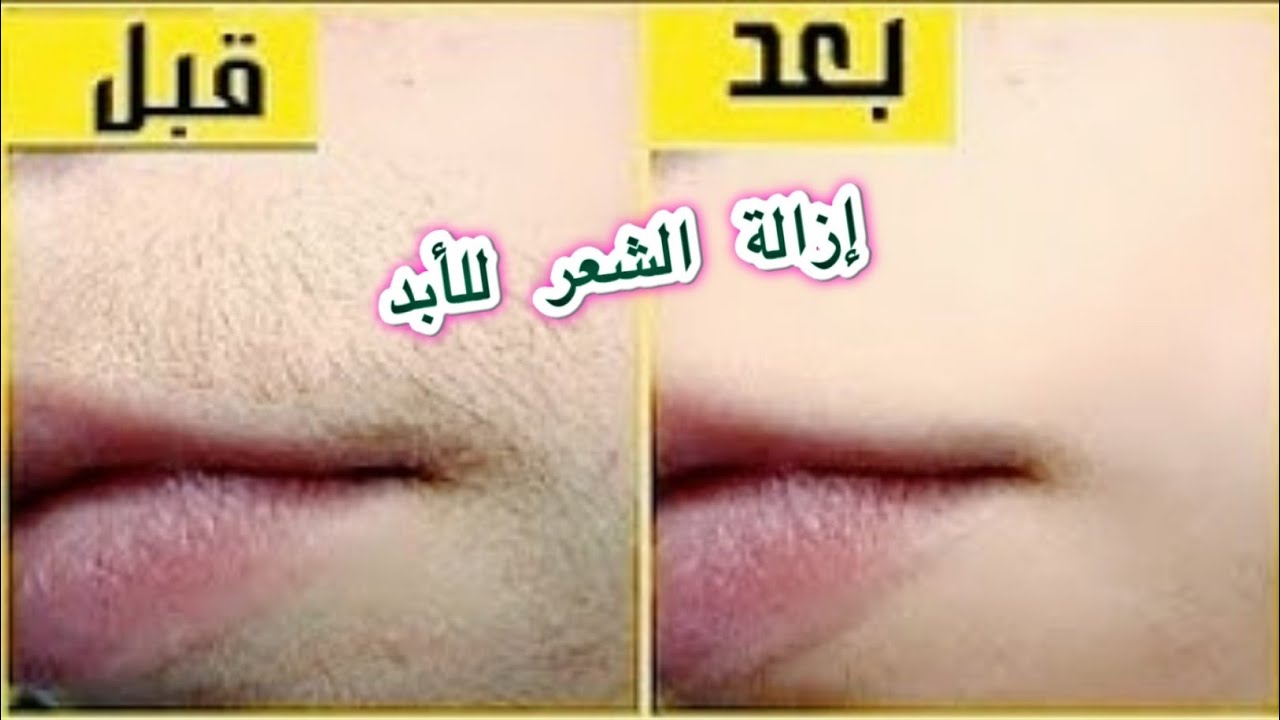 طريقة الملح لإزالة الشعر الزائد نهائيا بدون ألم في دقائق معدودة 5 طريقة الملح لإزالة الشعر الزائد نهائيا بدون ألم في دقائق معدودة