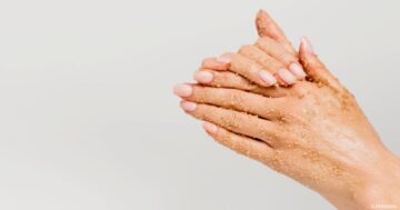 خلطة طبيعية منزلية لتبييض اليدين والرجلين والتخلص من الاسمرار
