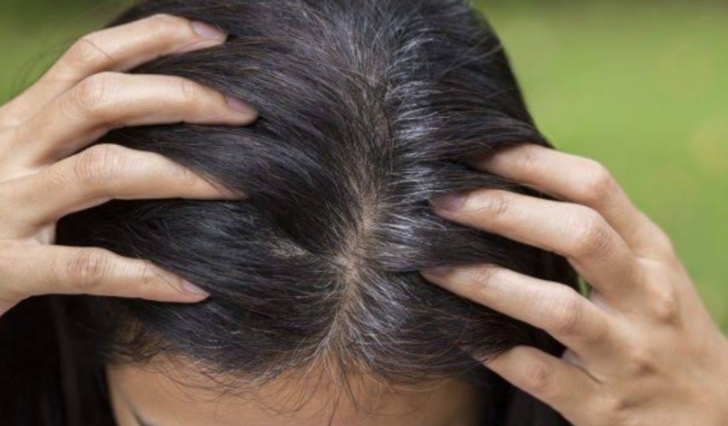 وصفات طبيعية جبارة للتخلص من الشعر الأبيض