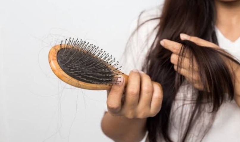 أفضل الوصفات الطبيعية لمنع تساقط الشعر والتخلص من الصلع