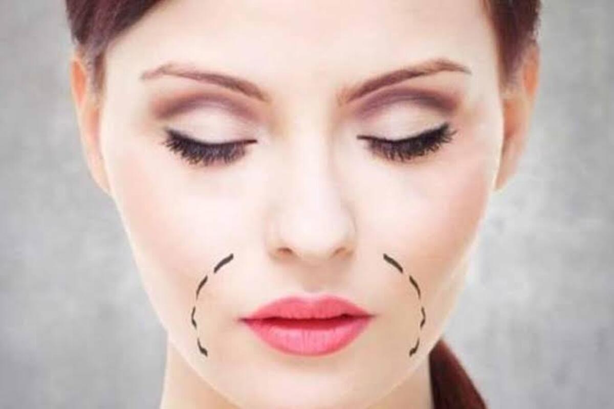 منها عصير البطاطس .. تخلصي من مشكلة الاسمرار حول الفم بتلك الوصفات الطبيعية 5 منها عصير البطاطس .. تخلصي من مشكلة الاسمرار حول الفم بتلك الوصفات الطبيعية