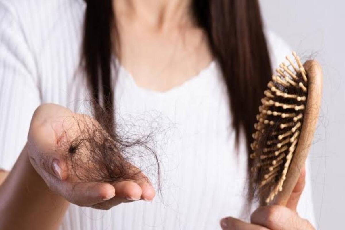جربيها مش هتخسري … وصفات للتخلص من تساقط الشعر مفعولها قوي جداً 5 جربيها مش هتخسري … وصفات للتخلص من تساقط الشعر مفعولها قوي جداً