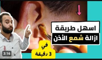 طريقة سحرية لإزالة الشمع من الأذن في المنزل بكل سهولة بدون ألم هتبقي نظيفة وزي الفل