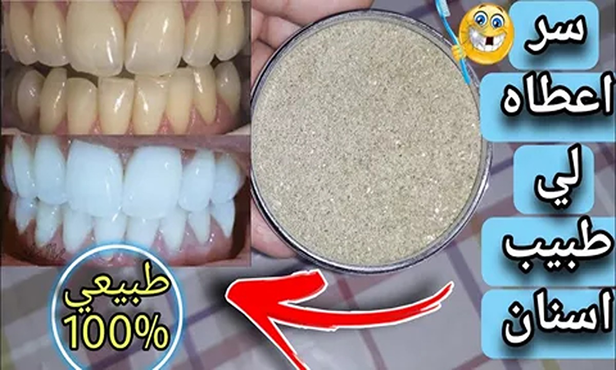 هتبقى بيضه بتلمع بدون اصفرار.. خلطة تبييض الاسنان في دقيقة قل وداعا الآن 5 هتبقى بيضه بتلمع بدون اصفرار.. خلطة تبييض الاسنان في دقيقة قل وداعا الآن