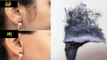 وداعًا لـوجع الشمع والسويت في إزالة الشعر… طريقة سحرية لإزالة شعر الوجه واليدين بدون ألم نهائيا!!