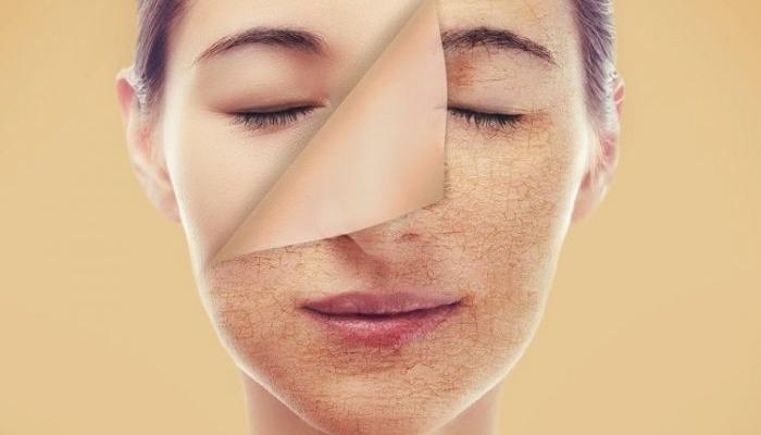 افضل الوصفات الطبيعية لتفتيح البشرة بنتيجة فعاله