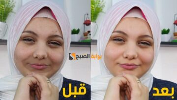 خليه كله بلون موحد .. وصفة طبيعية من الشوفان لتفتيح منطقة حول الفم هتخلي وشك ينور وتوحد لونه بأقل التكاليف ” متقوليش لعدوك عليها”