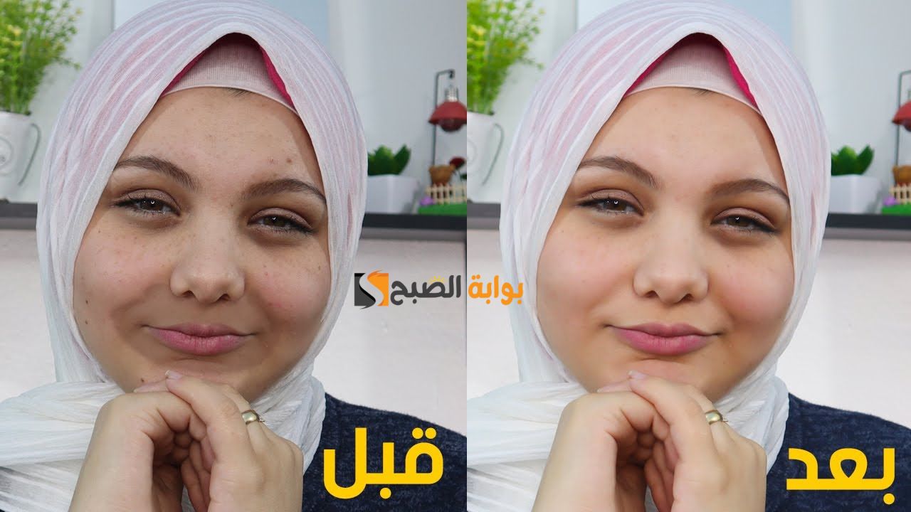 خليه كله بلون موحد .. وصفة طبيعية من الشوفان لتفتيح منطقة حول الفم هتخلي وشك ينور وتوحد لونه بأقل التكاليف " متقوليش لعدوك عليها" 5 خليه كله بلون موحد .. وصفة طبيعية من الشوفان لتفتيح منطقة حول الفم هتخلي وشك ينور وتوحد لونه بأقل التكاليف ” متقوليش لعدوك عليها”