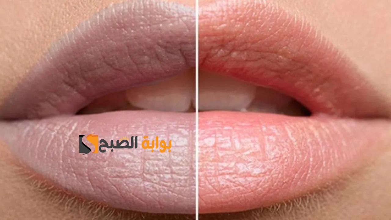 كأنك عملتي توريد .. وصفات طبيعية فعالة وقوية لعلاج مشكلة الشفايف الداكنة مع ماسك الفراولة انسي الغمقان" بياض ناصع وتحدي" 5 كأنك عملتي توريد .. وصفات طبيعية فعالة وقوية لعلاج مشكلة الشفايف الداكنة مع ماسك الفراولة انسي الغمقان” بياض ناصع وتحدي”