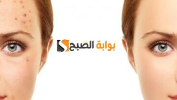 ‏خلي وشك زي البلور.. ماسك طبيعي من دقيق القمح لإزالة حب الشباب لأصحاب البشرة الدهنية والنتيجة واضحة من أول استخدام “بشرتك هتبقى زجاجية”